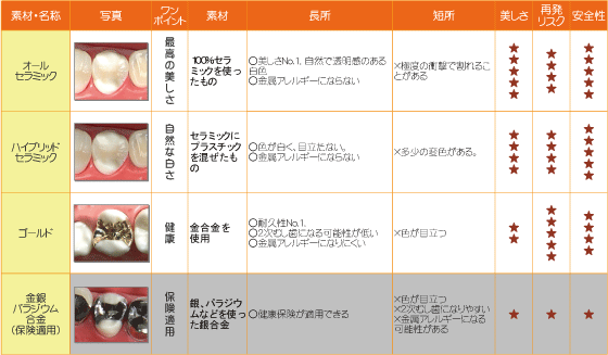 表